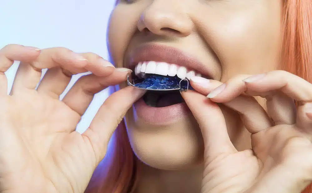 Woman wearing a clear dental retainer to maintain straight teeth after orthodontic treatment