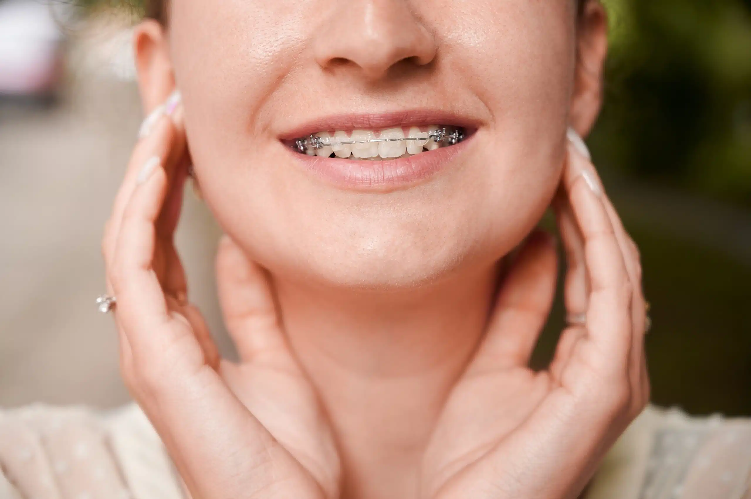 Close-up of a smiling person wearing braces with hands gently touching their cheeks